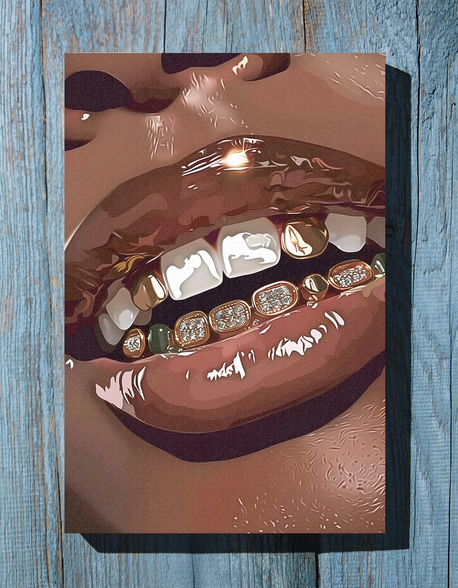 .75" Matte Canvas - Golden Grill Smile